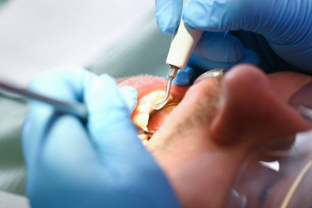Best Urgent Care for Lost Fillings or Crowns in Palermo, NJ